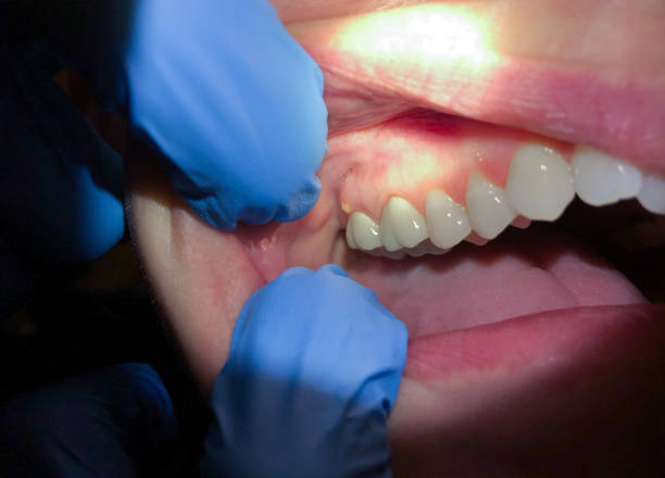 Best After-Hours Emergency Dentist in Topaz Ranch Estates, NV